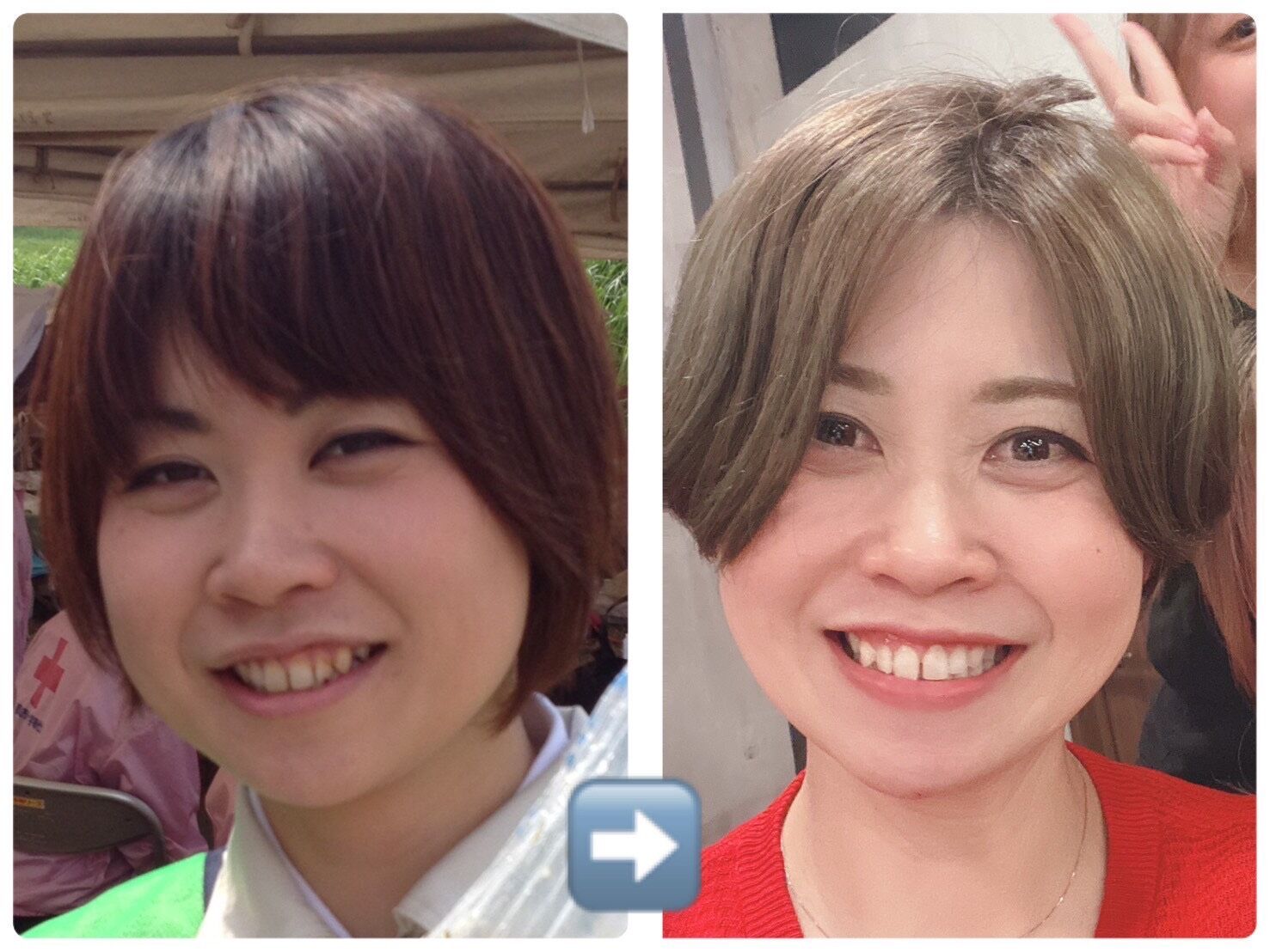 ビフォーアフター