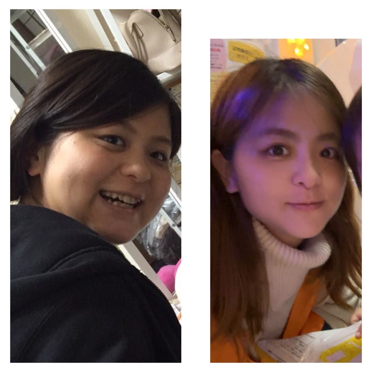 ビフォーアフター