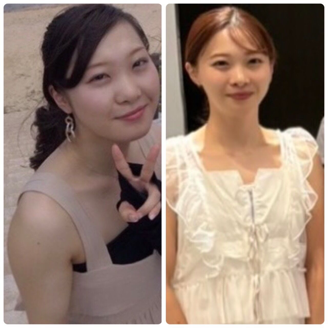 ビフォーアフター